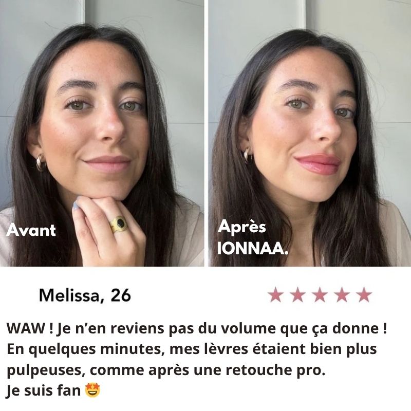 IONNAA REPULPE